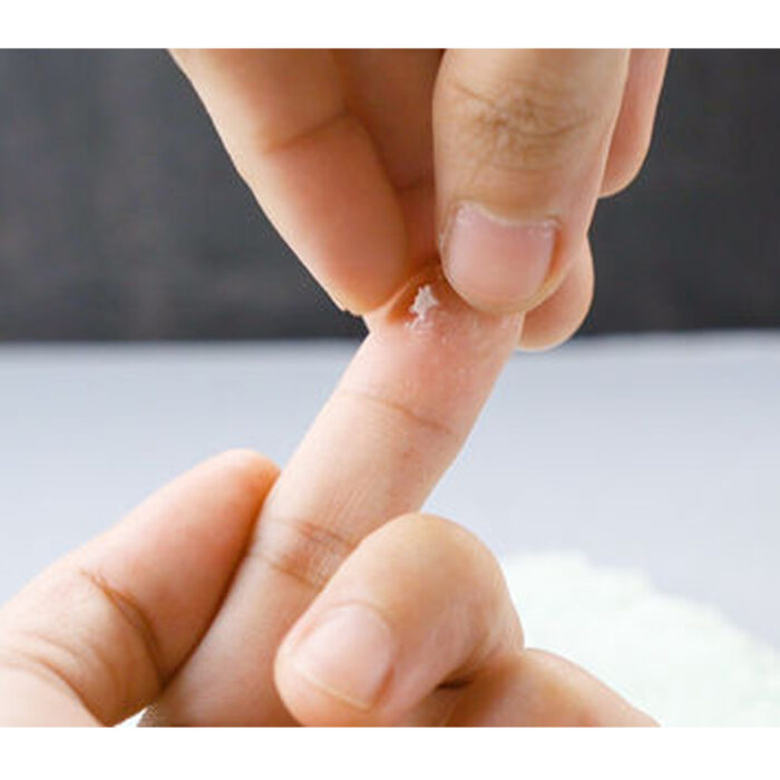 How to remove super glue from skin Daqiq Chimie Co.